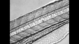 Blood cells circulating through zebrafish [upl. by Neelyt]