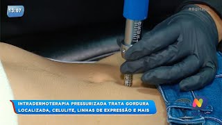 BG  Intradermoterapia pressurizada trata gordura localizada [upl. by Colver]