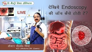 देखिये Endoscopy की जाँच कैसे होती है   देखिये LIVE  Dr VK Mishra MD DMGastro [upl. by Delia]