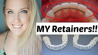 Retainers After Braces  Permanent and Temporary  Ashley Craig [upl. by Madancy]