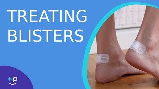 Treating Blisters  Daily Dos of Dermatology [upl. by Nykal]