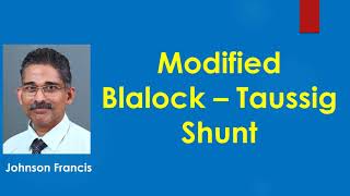 Modified Blalock – Taussig Shunt [upl. by Ezarra]