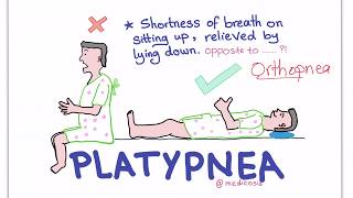 PlatypneaOrthodeoxia Syndrome [upl. by Nauqram979]