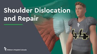 Top 3 Exercises After A Dislocated Shoulder [upl. by Ayokahs]