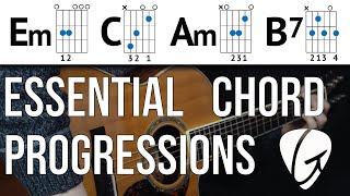 Chord Progression Practice  Em C Am B7  Beginner Guitar Lessons [upl. by Uehttam]