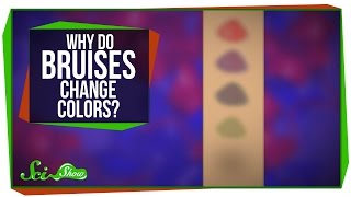 Why Do Bruises Change Colors [upl. by Neala]