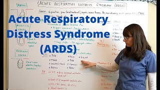 Acute Respiratory Distress Syndrome ARDS [upl. by Arramat]