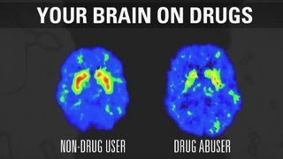 How addiction changes your brain [upl. by Batsheva]