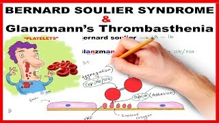 Bernard Soulier Syndrome amp Glanzmanns Thrombasthenia  Mnemonic Series  21 [upl. by Tasia]