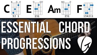 Chord Progression Practice  C E Am F  Beginner Guitar Lessons [upl. by Trueman]