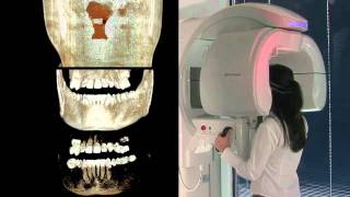 Cone Beam CT and 3D imaging [upl. by Aliuqat860]