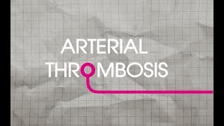 Arterial Thrombosis Explained [upl. by Huberto]