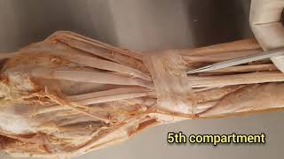 Extensor Retinaculum of the HandWrist [upl. by Jacqui]