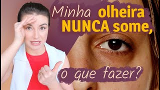 Olheiras Como tratar  Dica de Esteticista [upl. by Retsbew]