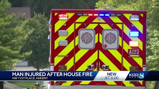 Man Injured After Ankeny House Fire [upl. by Merola]