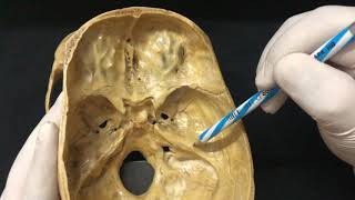 Skull Osteology  Cranial Cavity Anatomy [upl. by Alek247]