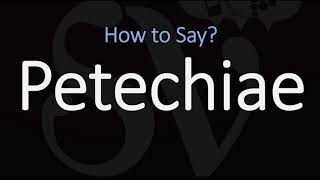 How to Pronounce Petechiae CORRECTLY Meaning amp Pronunciation [upl. by Irak]