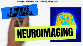 2Minute Neuroscience Neuroimaging [upl. by Johst212]