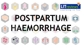 Prevention and Treatment of Postpartum Haemorrhage [upl. by Petey114]