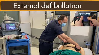 External defibrillation DC Shock [upl. by Moynahan855]