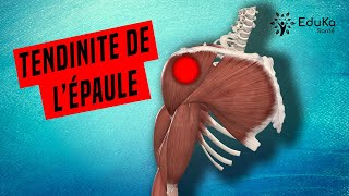 COMPRENDRE LA TENDINITE DE LÉPAULE Explications professionelles [upl. by Keith458]