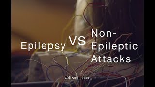 Epilepsy VS NonEpileptic Attacks Misdiagnosis amp Key Differences [upl. by Merce231]