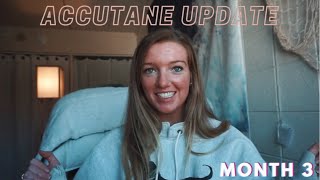 ACCUTANE MONTH 3 UPDATE how long does the purging phase last amp when will Accutane start to work [upl. by Zadoc]