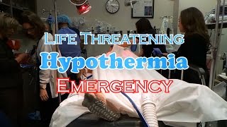 Neonatal Hypothermia  Pediatrics [upl. by Silvestro215]