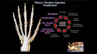 Flexor Tendon Injuries Treatment  Everything You Need To Know  Dr Nabil Ebraheim [upl. by Blackstock]