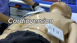 Cardioversion  Defibrillation Technique [upl. by Mit301]