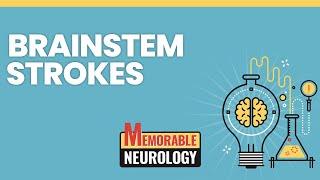 Brainstem Stroke Mnemonics Memorable Neurology Lecture 15 [upl. by Nylakcaj956]