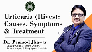 Urticaria Hives  CausesSymptoms amp Treatment [upl. by Aisel]