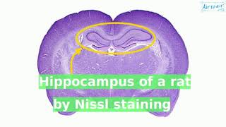 Nissl staining [upl. by Roselle695]