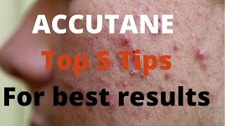 Accutane 5 tips by Dermatologists [upl. by Enirrok]