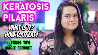 KERATOSIS PILARIS  KP  WHAT WHY TREATMENT amp TIPS  MAGIC CURE  MAITRAYEE HALDER [upl. by Emelina]