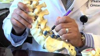 Surgical Procedures  Lumbar Laminectomy amp Discectomy [upl. by Japeth]