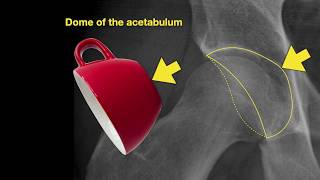 Anatomy of Hip Xrays [upl. by Medora599]