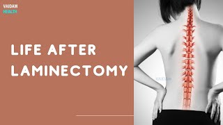 Life After Laminectomy [upl. by Farny626]