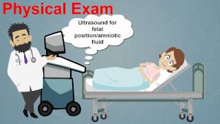 Topic 25 Premature Rupture of Membranes [upl. by Ahtoelc]