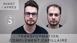 ► Complément capillaire  Transformation  BYSIX [upl. by Nanette139]