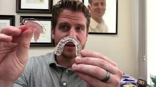 What Is The Best Orthodontic Retainer [upl. by Ihcehcu850]