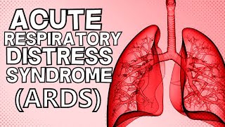 Acute Respiratory Distress Syndrome ARDS [upl. by Akemet]