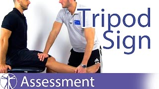 Tripod Sign  Hamstring Contractures [upl. by Langsdon77]