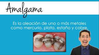 Resina dental vs Amalgama ¿Cuál es mejor [upl. by Nueoras537]