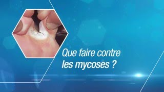 Le pied diabétique conseils pratiques par la Dr Aouiche [upl. by Ciryl959]