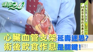 心臟血管支架 延壽迷思？ 術後飲食 規律作息 是解方！ 健康20 [upl. by Enoed]