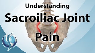 Understanding Sacroiliac Joint Pain [upl. by Rise605]