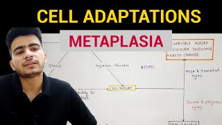 Metaplasia  Cell Adaptations 33  General Pathology  EOMS [upl. by Carlyle]