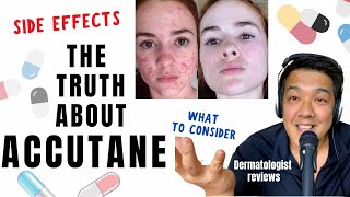 ACCUTANE  Dermatologist Review Unbiased [upl. by Namialus]