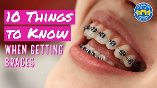 10 Things to Know When Getting Braces [upl. by Pearle]